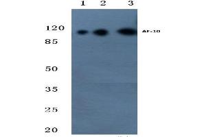 Western blot (WB) analysis of AF-10 antibody at 1/500 dilution. (MLLT10 抗体)