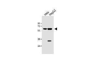 All lanes : Anti-hIL1R-p at 1:1000 dilution Lane 1: Hela whole cell lysate Lane 2: HepG2 whole cell lysate Lysates/proteins at 40 μg per lane. (IL1R1 抗体  (C-Term))