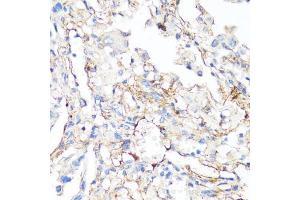 Immunohistochemistry (IHC) image for anti-Fibronectin 1 (FN1) (AA 2200-2355) antibody (ABIN7267194)