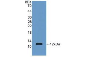 Western blot analysis of recombinant Human S100A11.