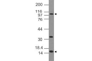 Image no. 1 for anti-DNA (Cytosine-5-)-Methyltransferase 3 alpha (DNMT3A) antibody (ABIN5027477) (DNMT3A 抗体)