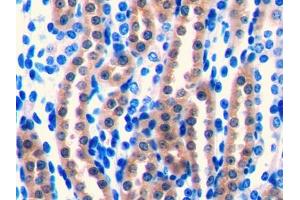 DAB staining on IHC-P; Samples: Mouse Kidney Tissue (FGF1 抗体  (AA 16-155))