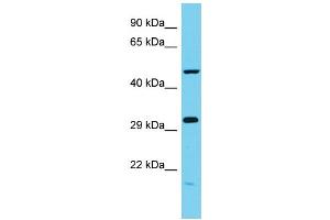 Host: Rabbit Target Name: C6orf211 Sample Type: MCF7 Whole Cell lysates Antibody Dilution: 1. (C6ORF211 抗体  (N-Term))