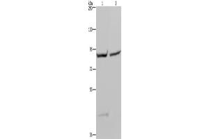 Western Blotting (WB) image for anti-Glycogen Synthase 1 (Muscle) (GYS1) antibody (ABIN2423549) (Glycogen Synthase 1 抗体)