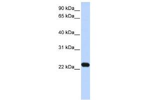 WB Suggested Anti-HBXIP Antibody Titration: 0. (HBXIP 抗体  (N-Term))