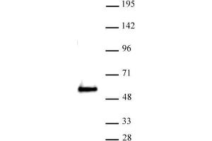 SMARCE1 antibody (pAb) tested by Western blot. (SMARCE1 抗体  (C-Term))