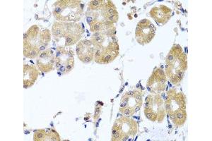 Immunohistochemistry of paraffin-embedded Human stomach using RHOB Polyclonal Antibody at dilution of 1:100 (40x lens). (RHOB 抗体)