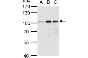 WB Image Aconitase 1 antibody detects Aconitase 1 protein by western blot analysis. (Aconitase 1 抗体)