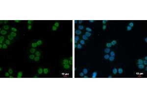 ICC/IF Image ZNF45 antibody [N2C3] detects ZNF45 protein at nucleus by immunofluorescent analysis. (ZNF45 抗体)