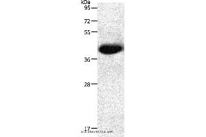 Western blot analysis of Mouse heart tissue, using NGFR Polyclonal Antibody at dilution of 1:950 (NGFR 抗体)