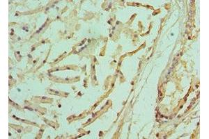 Immunohistochemistry of paraffin-embedded human prostate tissue using ABIN7142216 at dilution of 1:100