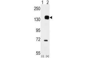 Western blot analysis of TIE2 antibody and 293 cell lysate either nontransfected (Lane 1) or transiently transfected with the TEK gene (2).
