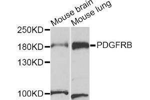 Western blot analysis of extracts of mouse brain and mouse lung cell lines, using PDGFRB antibody. (PDGFRB 抗体)
