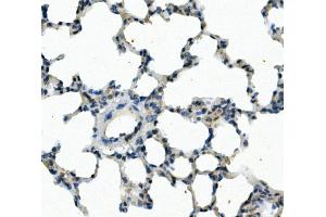 IHC analysis of FOXF1 using anti-FOXF1 antibody (ABIN7601744). (FOXF1 抗体  (AA 44-379))