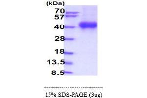 SDS-PAGE (SDS) image for Interleukin 2 Receptor, gamma (IL2RG) (AA 23-262) protein (His tag) (ABIN5854210) (IL2RG Protein (AA 23-262) (His tag))
