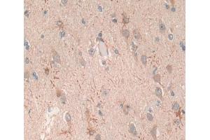 Used in DAB staining on fromalin fixed paraffin- embedded brain tissue (Glutamate Receptor 3 抗体  (AA 649-823))