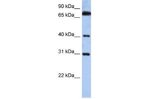 WB Suggested Anti-DHRSX Antibody Titration: 0. (DHRSX 抗体  (C-Term))