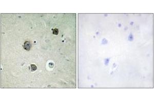 Immunohistochemistry analysis of paraffin-embedded human brain tissue, using CDK5 (Ab-15) Antibody. (CDK5 抗体  (AA 1-50))