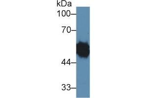 Western Blotting (WB) image for anti-Ly1 Antibody Reactive (LYAR) (AA 270-388) antibody (ABIN7439300)