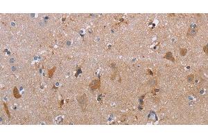 Immunohistochemistry of paraffin-embedded Human brain using MAGEF1 Polyclonal Antibody at dilution of 1:30 (MAGEF1 抗体)