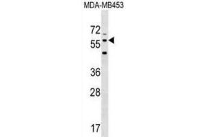Western Blotting (WB) image for anti-Leucine Rich Repeat Transmembrane Neuronal 2 (LRRTM2) antibody (ABIN3000490) (LRRTM2 抗体)