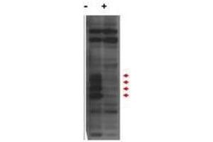 Western blot using  affinity purified anti-MLF1IP / PBIP1 antibody shows detection of endogenous MLF1IP protein (a tier of four modified protein bands indicated by the arrowheads) in lysates of Hela cells (- lane).