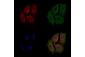 ABIN6263362 and ABIN6279017 staining Hela cells by IF/ICC. (MRPL19 抗体  (Internal Region))