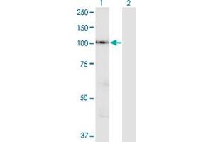 Western Blot analysis of VPS41 expression in transfected 293T cell line by VPS41 polyclonal antibody (A01). (VPS41 抗体  (AA 755-853))