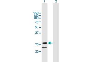 Western Blot analysis of C20orf71 expression in transfected 293T cell line by C20orf71 MaxPab polyclonal antibody. (BPIFA3 抗体  (AA 1-218))