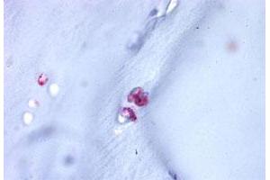 Immunohistochemistry (Formalin/PFA-fixed paraffin-embedded sections) of human cartilage tissue with ACAN polyclonal antibody . (Aggrecan 抗体  (C-Term))