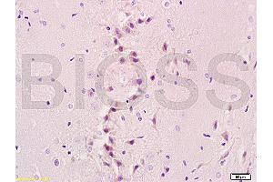 Formalin-fixed and paraffin embedded rat brain tissue labeled with Anti-NIS Polyclonal Antibody, Unconjugated (ABIN668751) at 1:200, followed by conjugation to the secondary antibody and DAB staining (SLC5A5 抗体  (AA 525-618))