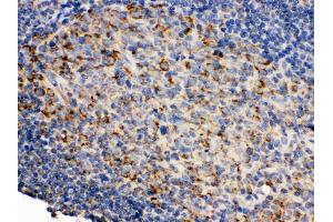 Immunohistochemistry (Paraffin-embedded Sections) (IHC (p)) image for anti-CD19 Molecule (CD19) (AA 307-337), (Middle Region) antibody (ABIN3043389)