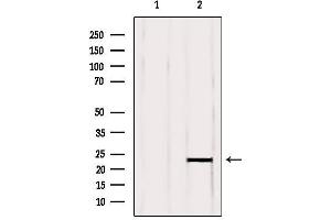 Western blot analysis of extracts from Mouse brain, using RBBP9 Antibody. (RBBP9 抗体  (Internal Region))