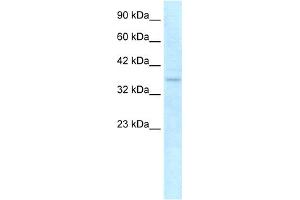 WB Suggested Anti-NLRC4 Antibody Titration: 0. (NLRC4 抗体  (C-Term))
