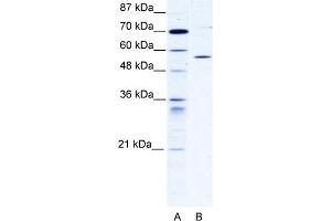 CCT4 antibody - C-terminal region  validated by WB using 293T cells lysate CCT4 is supported by BioGPS gene expression data to be expressed in HEK293T (CCT4 抗体  (C-Term))