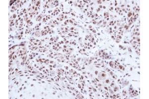 IHC-P Image Immunohistochemical analysis of paraffin-embedded Cal27 xenograft , using PRPF39, antibody at 1:500 dilution.