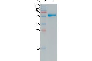 SDS-PAGE (SDS) image for Coxsackie Virus and Adenovirus Receptor (CXADR) (AA 20-237) protein (Fc Tag) (ABIN7491371)