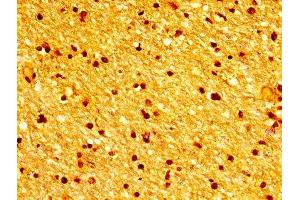 Immunohistochemistry of paraffin-embedded human brain tissue using ABIN7173684 at dilution of 1:100 (TUBB3 抗体  (AA 1-210))