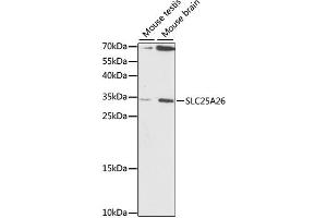 Western blot analysis of extracts of various cell lines, using SLC25A26 antibody.