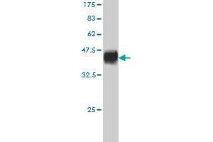 Western Blot detection against Immunogen (36. (MCHR1 抗体  (AA 14-113))