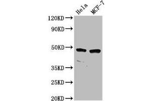 Western Blot Positive WB detected in: Hela whole cell lysate, MCF-7 whole cell lysate All lanes: NSUN5 antibody at 2. (NSUN5 抗体  (AA 362-466))