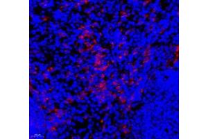Immunofluorescence of paraffin embedded mouse spleen using IL-27A (ABIN7074367) at dilution of 1: 800 (400x lens) (IL27 抗体)