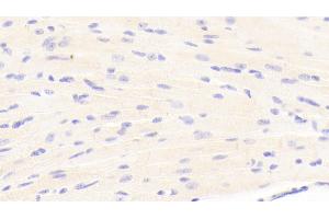 Detection of LAMb1 in Mouse Cardiac Muscle Tissue using Polyclonal Antibody to Laminin Beta 1 (LAMb1) (Laminin beta 1 抗体  (AA 1053-1258))