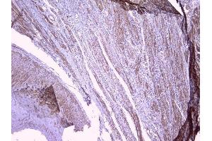 IHC analysis of PBP using anti-PBP antibody (ABIN5693043). (PEBP1 抗体)