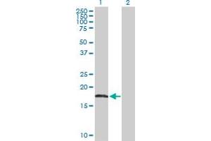 Western Blot analysis of AHNAK expression in transfected 293T cell line by AHNAK MaxPab polyclonal antibody. (AHNAK 抗体  (AA 1-149))