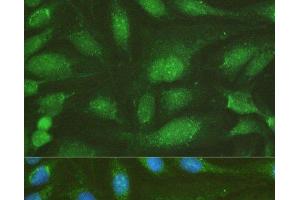 Immunofluorescence analysis of U-2OS cells using NHEJ1 Polyclonal Antibody at dilution of 1:100. (NHEJ1 抗体)