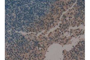 Detection of uPA in Mouse Spleen Tissue using Polyclonal Antibody to Plasminogen Activator, Urokinase (uPA) (PLAU 抗体  (AA 180-433))