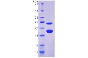 SDS-PAGE analysis of Rat AVPI1 Protein. (AVPI1 蛋白)