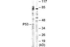 Western blot analysis of extracts from COS7 cells, treated with UV 5', using p53 (Ab-20) Antibody. (p53 抗体  (AA 10-59))