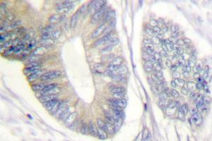 Image no. 1 for anti-SHC (Src Homology 2 Domain Containing) Transforming Protein 1 (SHC1) antibody (ABIN271910) (SHC1 抗体)